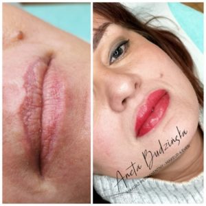 Aneta Budzinska makijaz permanentny usta
