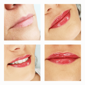 Aneta Budzinska makijaz permanentny usta