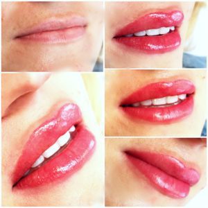 Aneta Budzinska makijaz permanentny usta