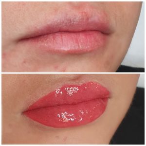 Aneta Budzinska makijaz permanentny usta