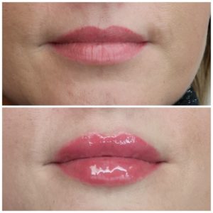 Aneta Budzinska modelowanie ust