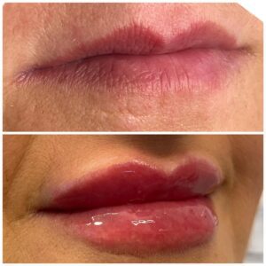 WhatsApp Image 2025-01-13 at 20.35.53